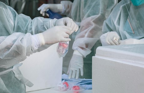Historia powstania i jak wygląda produkcja worków strunowych